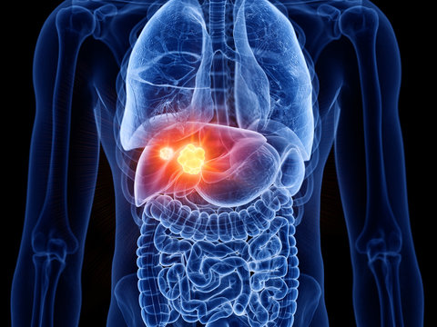 Modern Liver Imaging at Livasa Hoshiarpur - Current Cirrhosis Assessment