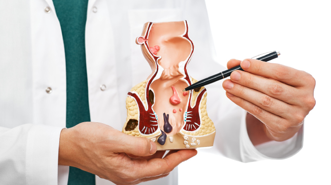 Pile Surgery Pain Experience: What to Expect at Livasa Hospital in General Surgery
