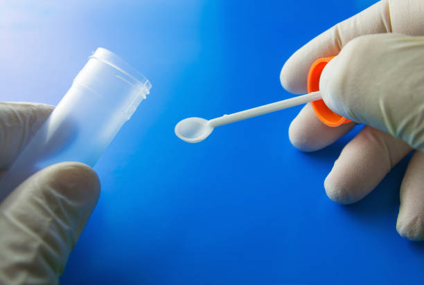 Stool Test, Culture & Sensitivity in Amritsar: When Is It Needed?