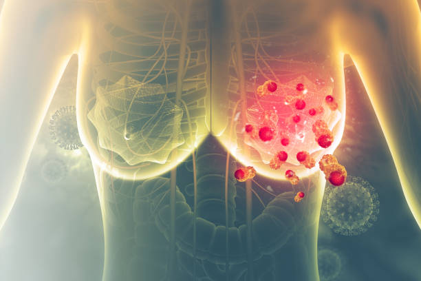 Complete Breast Cancer Staging at Livasa Hoshiarpur - Total Treatment Planning