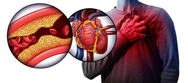 Focused LAD Blockage Treatment at Livasa Hoshiarpur - Targeted Cardiac Intervention