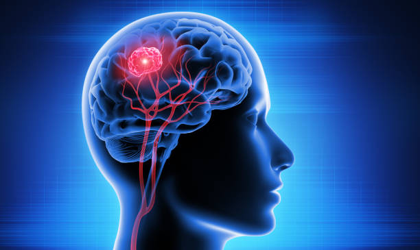 Affordable Brain Tumor Treatment at Livasa Nawanshahr - Accessible Neurosurgery Care