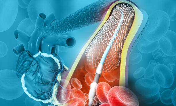 Professional Angiography & Angioplasty at Livasa Amritsar - Expert Cardiac Procedures