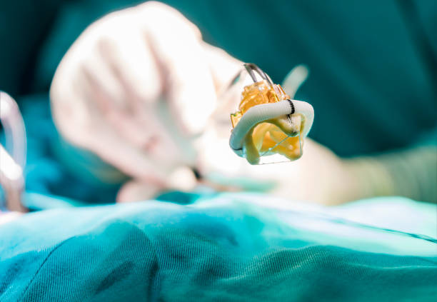 Professional MVR Surgery at Livasa Amritsar - Expert Mitral Valve Replacement