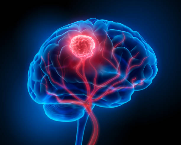 Comprehensive Brain Tumor Care at Livasa Amritsar - All Types & Stages