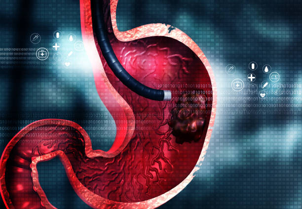 Modern Endoscopy for Stomach Cancer at Livasa Hoshiarpur - Current Diagnostic Procedures