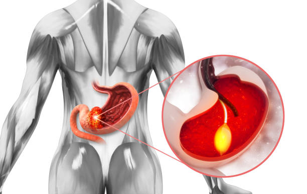 Complete Stomach Cancer Risk Assessment at Livasa Hoshiarpur - Total Age, Diet & Lifestyle Analysis