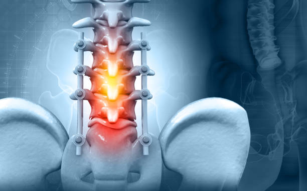 Comprehensive Spinal Stenosis Surgery at Livasa Amritsar - Complete Spine Solutions