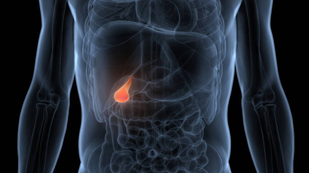 Gallstones in Obesity and Weight Loss: Understanding the Connection for Punjab Patients