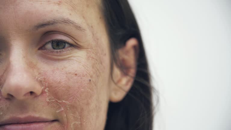 Causes Related to Dry Skin – Expert Insights by Dr. Bikram Jit Singh in Amritsar