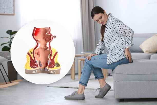 Are Piles and Fissures Treatable Without Surgery? Non-Surgical Treatments at Livasa Hospital Punjab