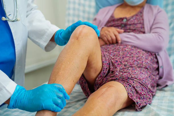 Comprehensive Knee Replacement Aftercare at Livasa Amritsar - Complete Recovery Guidelines
