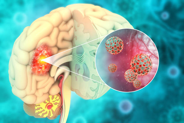 Precise Brain Tumor Diagnosis at Livasa Amritsar - State-of-the-Art Imaging