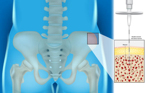 Comprehensive Bone Marrow Disorders Care at Livasa Amritsar - Expert Blood Disease Treatment