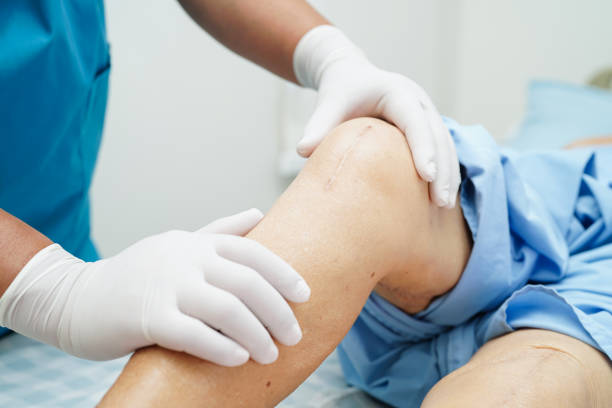 Knee Replacement Aftercare at Livasa Mohali - Post-Surgery Guidelines