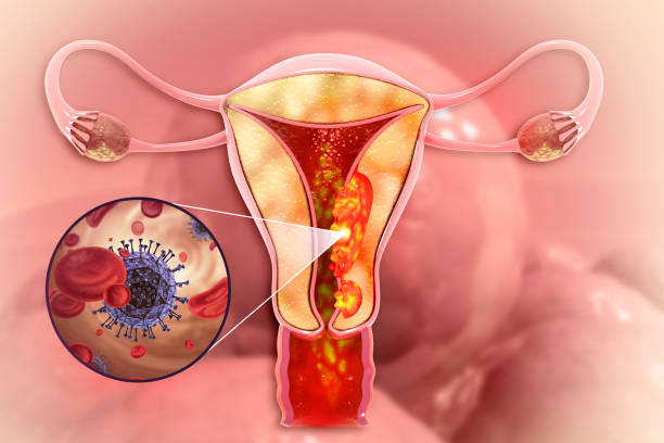 Complete Uterine Cancer Care at Livasa Hoshiarpur - Total Testing, Symptoms & Treatment