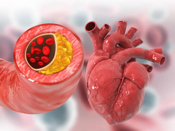 Heart Blockage Tests at Livasa Mohali - Advanced Cardiac Diagnostics