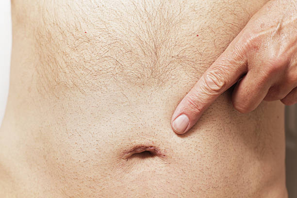 Can a Hernia Grow in Size? Understanding Progression for Punjab Patients