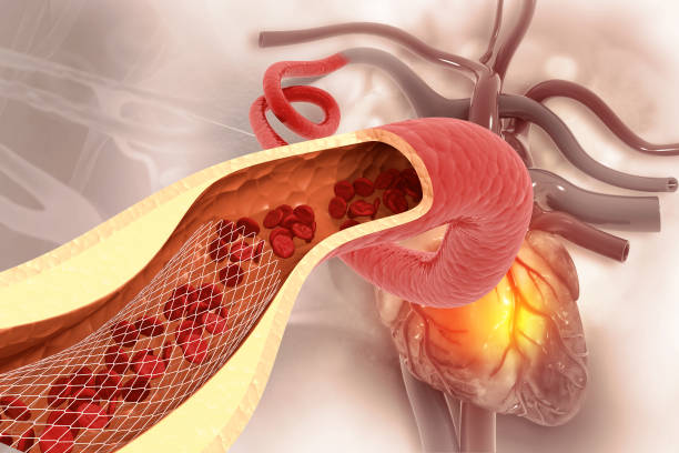 Best Cardiologists for Stenting and Angiography in Amritsar