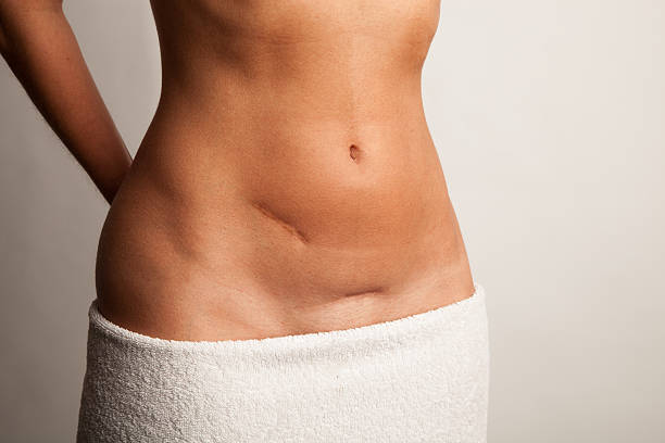 Benefits of Laparoscopic Inguinal Hernia Repair for Punjab Patients
