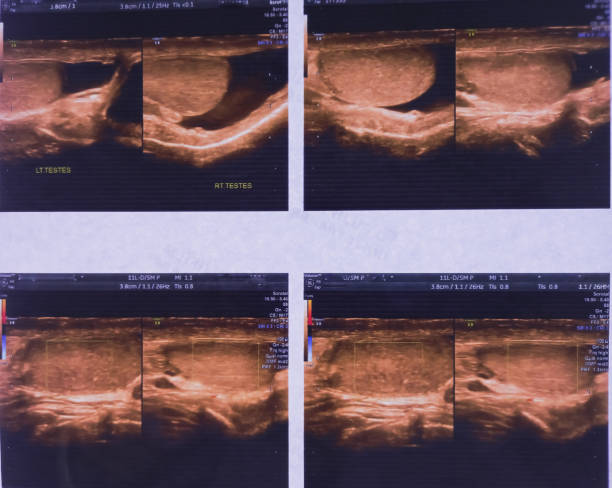 Diagnosing a Hernia: Ultrasound, CT Scan, MRI or X-ray? Comprehensive Care Options in Punjab