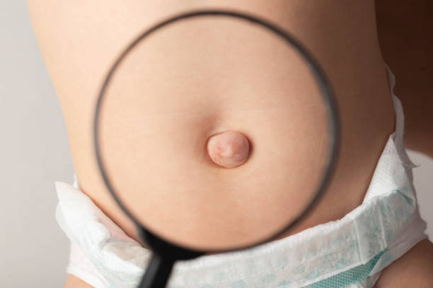 Diagnosing and Managing Hernias in Children: Expert Advice from Livasa Hospital Punjab