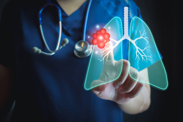 Best Oncologists for Lung Cancer in Amritsar