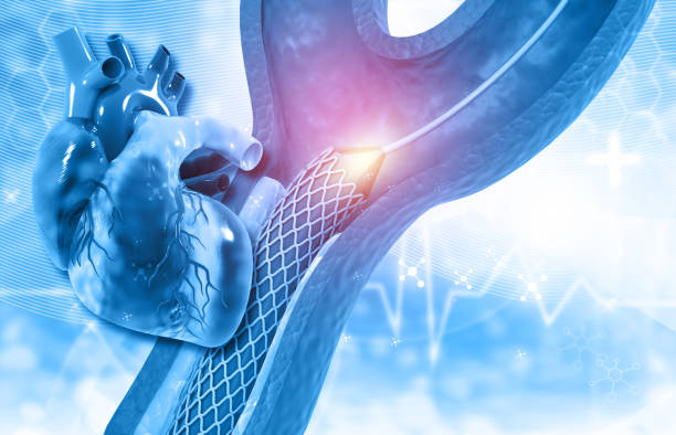 Effective Aortic Stenosis Treatment at Livasa Hoshiarpur - Proven Valve Solutions