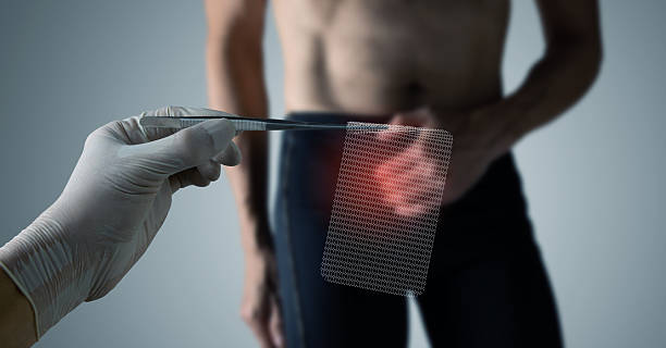 Cost of Inguinal Hernia Surgery in Punjab: What You Should Know