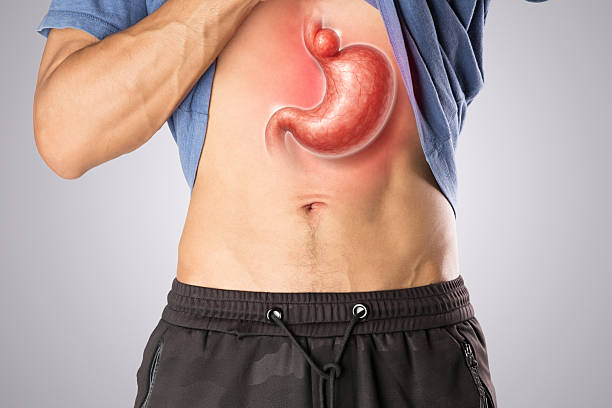 How Can Hiatal Hernia Affect Cardiac Function? Expert Insights for Punjab Patients