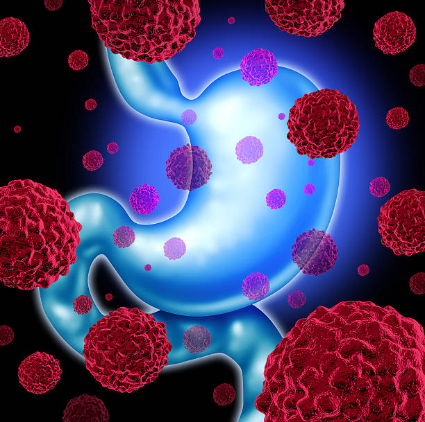 Modern Stomach Cancer Imaging at Livasa Hoshiarpur - Current Diagnostic Scans