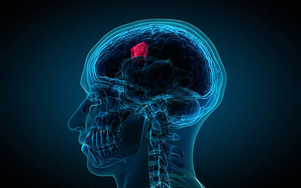 Detailed Brain Tumor Care at Livasa Nawanshahr - All Types & Treatment Options