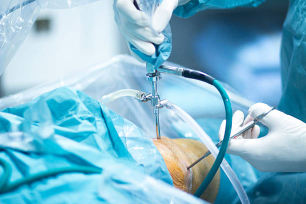 Arthroscopic Knee Surgery at Livasa Mohali - Minimally Invasive Treatment