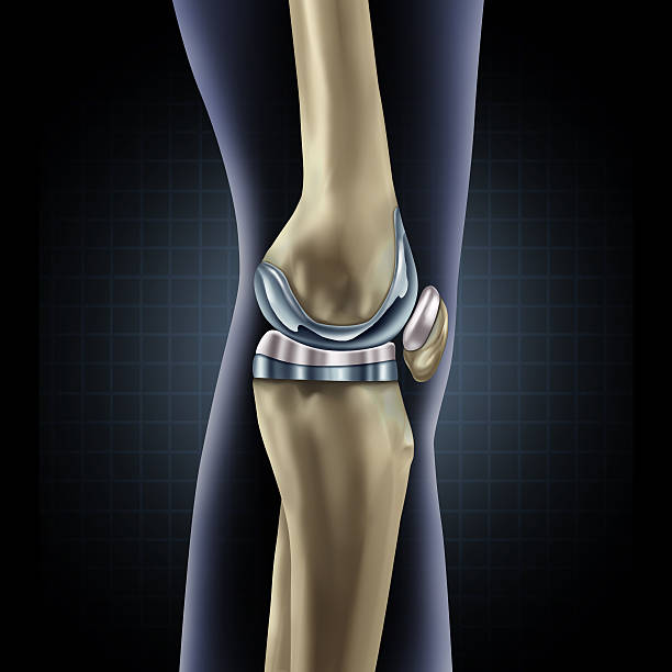Expert Revision Knee Replacement at Livasa Amritsar - Complex Joint Surgery Specialists
