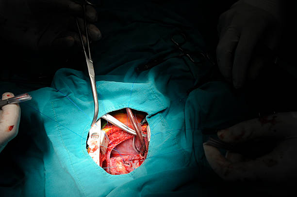 Caring Pediatric Heart Valve Surgery at Livasa Nawanshahr - Children's Cardiac Care