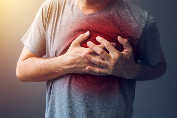 Myocardial Infarction (MI): Management and Recovery