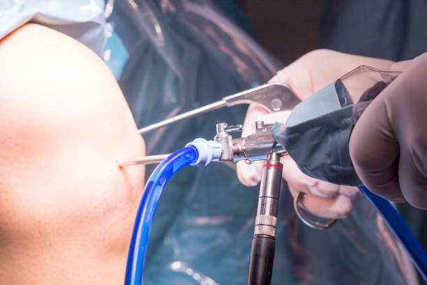 Current Arthroscopic Knee Surgery at Livasa Hoshiarpur - Modern Minimally Invasive Treatment
