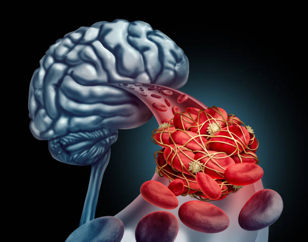 Brain Aneurysm & AVM Treatment in Amritsar: Coiling vs Clipping