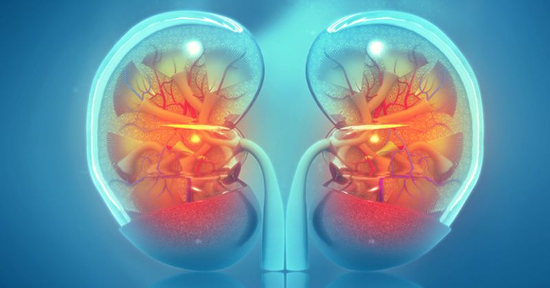 Understanding Kidney Transplant Costs in India: Financial Planning Guide