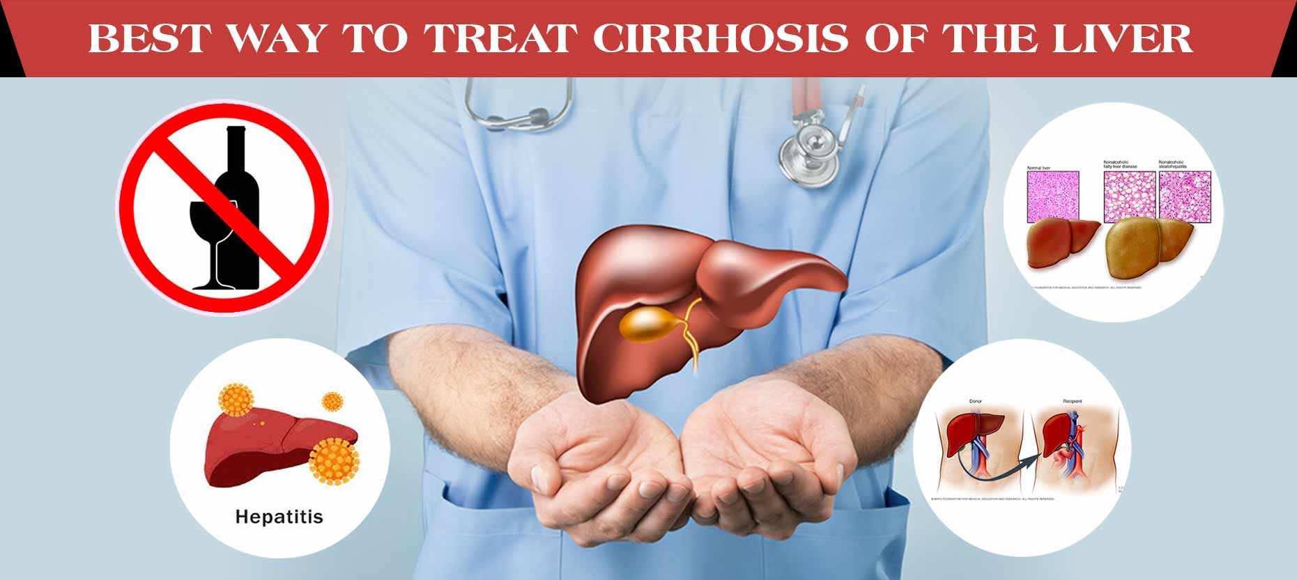 Liver Cirrhosis Treatment at Livasa Mohali - Advanced Hepatology Care