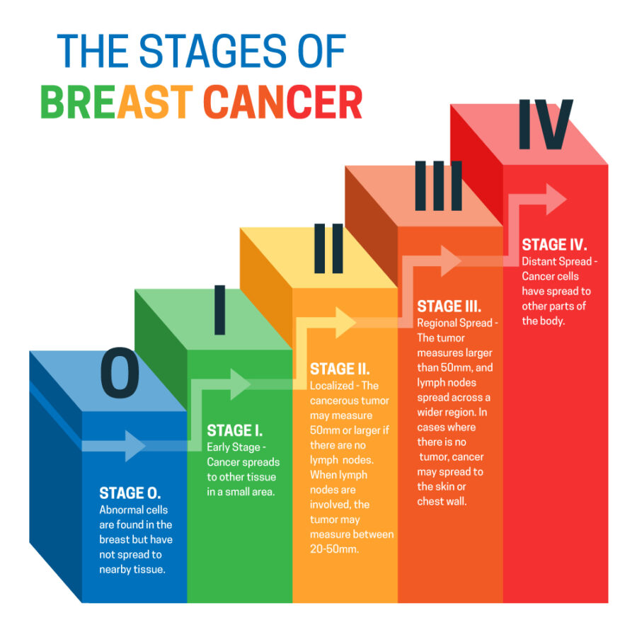 Breast Cancer Stages at Livasa Mohali - Comprehensive Treatment