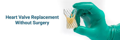 Non-Surgical Heart Valve Treatment at Livasa Mohali - Alternative Options