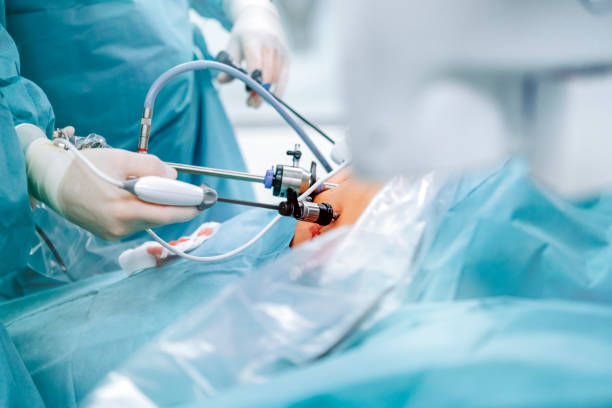 How to Choose the Best Laparoscopic Surgeon in Mohali